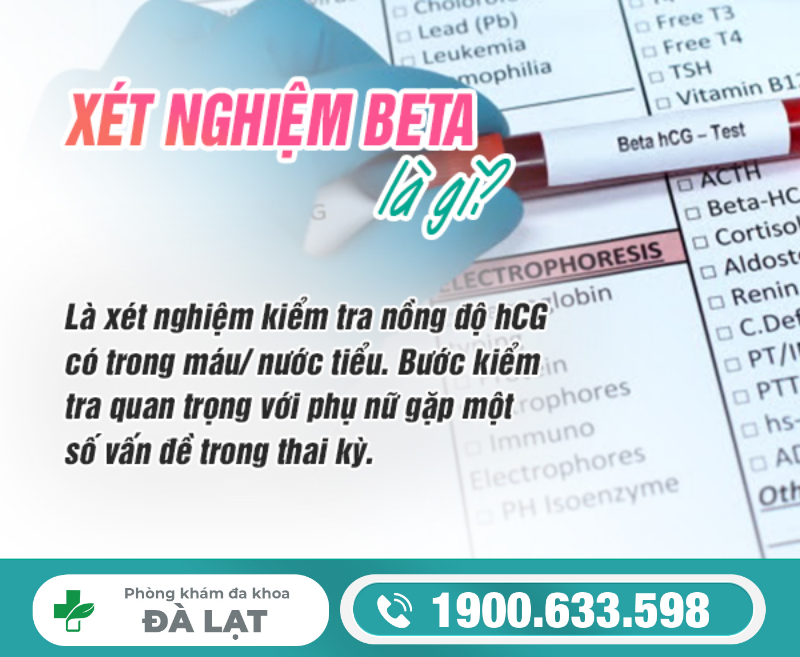 Hình ảnh minh họa
